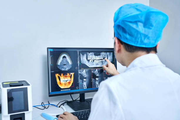 Best Emergency Dental Care for Broken or Chipped Teeth in Kent, WA